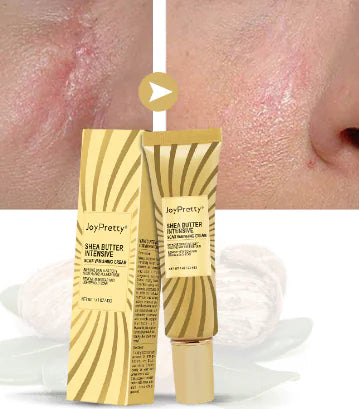 Mango-Shea Butter Scar Removal Cream (One Piece)
